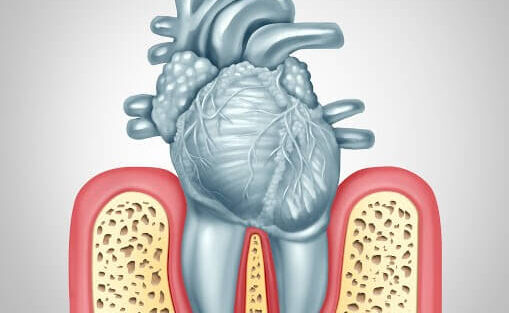 دندانپزشکی بیماران افتادگی دریچه قلب