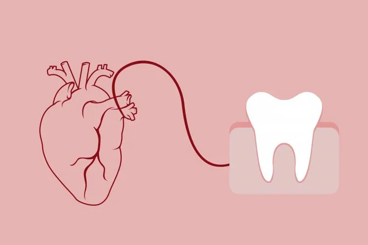 Dental Care for Cardiac Patients