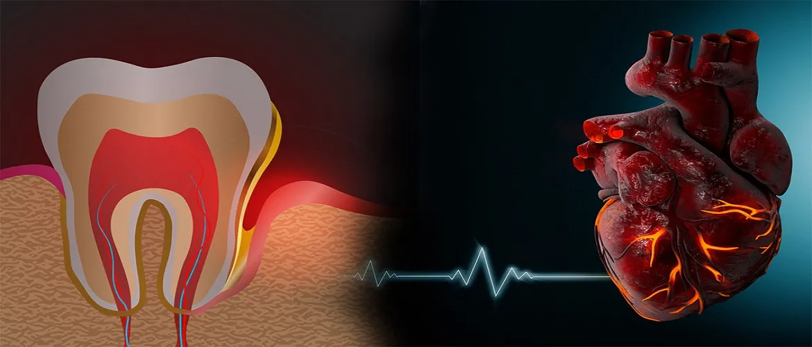 Dental Care for Cardiac Patients