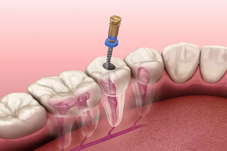 طب الأسنان لمرضى القلب